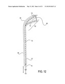 Methods of Transvascular Retrograde Access Placement and Devices for     Facilitating the Placement diagram and image