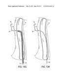 Methods of Transvascular Retrograde Access Placement and Devices for     Facilitating the Placement diagram and image