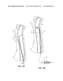 Methods of Transvascular Retrograde Access Placement and Devices for     Facilitating the Placement diagram and image