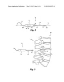 Apparatus and Method for Locating Defects in Bone Tissue diagram and image