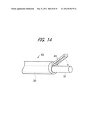 ULTRASOUND SURGICAL APPARATUS diagram and image