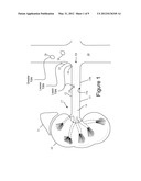 RENAL DENERVATION CATHETER AND METHOD USING pH ALTERATION diagram and image