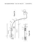 RENAL DENERVATION CATHETER AND METHOD USING pH ALTERATION diagram and image