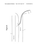 RENAL DENERVATION CATHETER AND METHOD USING pH ALTERATION diagram and image