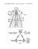 CATHETER APPARATUSES, SYSTEMS, AND METHODS FOR RENAL NEUROMODULATION diagram and image