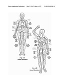 CATHETER APPARATUSES, SYSTEMS, AND METHODS FOR RENAL NEUROMODULATION diagram and image