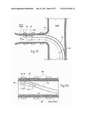 CATHETER APPARATUSES, SYSTEMS, AND METHODS FOR RENAL NEUROMODULATION diagram and image