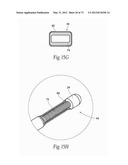 CATHETER APPARATUSES, SYSTEMS, AND METHODS FOR RENAL NEUROMODULATION diagram and image