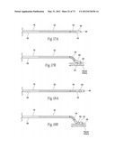 CATHETER APPARATUSES, SYSTEMS, AND METHODS FOR RENAL NEUROMODULATION diagram and image