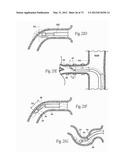 CATHETER APPARATUSES, SYSTEMS, AND METHODS FOR RENAL NEUROMODULATION diagram and image