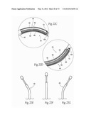 CATHETER APPARATUSES, SYSTEMS, AND METHODS FOR RENAL NEUROMODULATION diagram and image