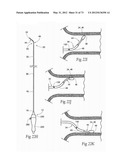 CATHETER APPARATUSES, SYSTEMS, AND METHODS FOR RENAL NEUROMODULATION diagram and image