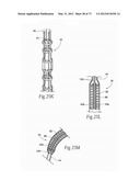 CATHETER APPARATUSES, SYSTEMS, AND METHODS FOR RENAL NEUROMODULATION diagram and image