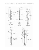 CATHETER APPARATUSES, SYSTEMS, AND METHODS FOR RENAL NEUROMODULATION diagram and image