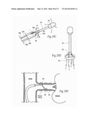 CATHETER APPARATUSES, SYSTEMS, AND METHODS FOR RENAL NEUROMODULATION diagram and image