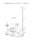 CATHETER APPARATUSES, SYSTEMS, AND METHODS FOR RENAL NEUROMODULATION diagram and image