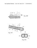 CATHETER APPARATUSES, SYSTEMS, AND METHODS FOR RENAL NEUROMODULATION diagram and image