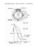 CATHETER APPARATUSES, SYSTEMS, AND METHODS FOR RENAL NEUROMODULATION diagram and image