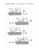 CATHETER APPARATUSES, SYSTEMS, AND METHODS FOR RENAL NEUROMODULATION diagram and image