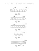 CATHETER APPARATUSES, SYSTEMS, AND METHODS FOR RENAL NEUROMODULATION diagram and image