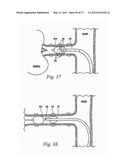 CATHETER APPARATUSES, SYSTEMS, AND METHODS FOR RENAL NEUROMODULATION diagram and image