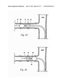 CATHETER APPARATUSES, SYSTEMS, AND METHODS FOR RENAL NEUROMODULATION diagram and image