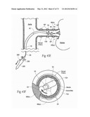 CATHETER APPARATUSES, SYSTEMS, AND METHODS FOR RENAL NEUROMODULATION diagram and image