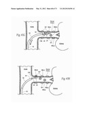 CATHETER APPARATUSES, SYSTEMS, AND METHODS FOR RENAL NEUROMODULATION diagram and image