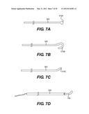 ENDOVASCULAR DEVICES AND METHODS FOR EXPLOITING INTRAMURAL SPACE diagram and image