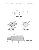 ENDOVASCULAR DEVICES AND METHODS FOR EXPLOITING INTRAMURAL SPACE diagram and image