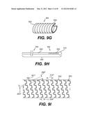 ENDOVASCULAR DEVICES AND METHODS FOR EXPLOITING INTRAMURAL SPACE diagram and image