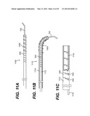 ENDOVASCULAR DEVICES AND METHODS FOR EXPLOITING INTRAMURAL SPACE diagram and image