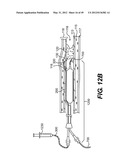 ENDOVASCULAR DEVICES AND METHODS FOR EXPLOITING INTRAMURAL SPACE diagram and image