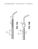 ENDOVASCULAR DEVICES AND METHODS FOR EXPLOITING INTRAMURAL SPACE diagram and image