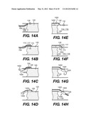 ENDOVASCULAR DEVICES AND METHODS FOR EXPLOITING INTRAMURAL SPACE diagram and image