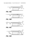 ENDOVASCULAR DEVICES AND METHODS FOR EXPLOITING INTRAMURAL SPACE diagram and image