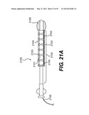 ENDOVASCULAR DEVICES AND METHODS FOR EXPLOITING INTRAMURAL SPACE diagram and image