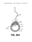 ENDOVASCULAR DEVICES AND METHODS FOR EXPLOITING INTRAMURAL SPACE diagram and image