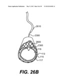 ENDOVASCULAR DEVICES AND METHODS FOR EXPLOITING INTRAMURAL SPACE diagram and image