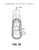 ENDOVASCULAR DEVICES AND METHODS FOR EXPLOITING INTRAMURAL SPACE diagram and image