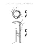 ENDOVASCULAR DEVICES AND METHODS FOR EXPLOITING INTRAMURAL SPACE diagram and image