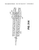 ENDOVASCULAR DEVICES AND METHODS FOR EXPLOITING INTRAMURAL SPACE diagram and image