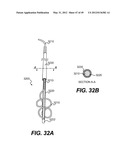 ENDOVASCULAR DEVICES AND METHODS FOR EXPLOITING INTRAMURAL SPACE diagram and image