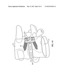 System and Method for Stabilizing Vertebrae in Spine Surgery Through a     Lateral Access Channel diagram and image