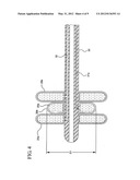 Interspinous Process Spacer Diagnostic Parallel Balloon Catheter and     Methods of Use diagram and image