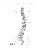 Medical Procedure Involving Protective Pad diagram and image