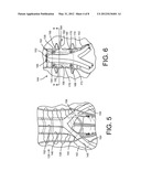 Medical Procedure Involving Protective Pad diagram and image