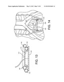 Medical Procedure Involving Protective Pad diagram and image