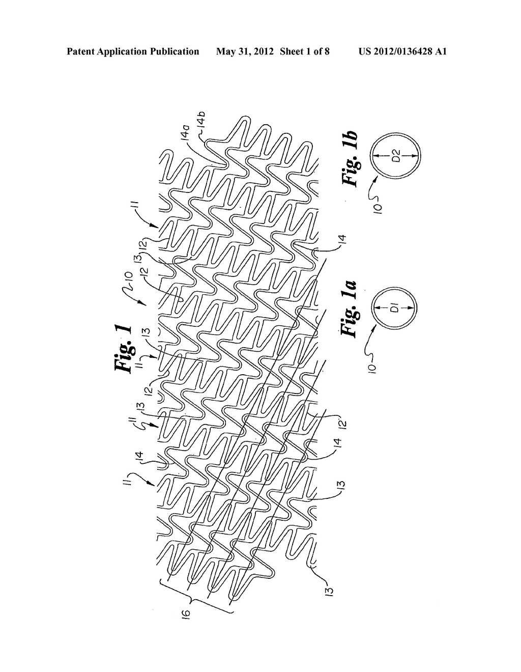 Helical Stent Design - diagram, schematic, and image 02