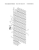 Helical Stent Design diagram and image